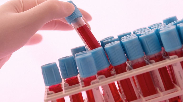 Jak radzic sobie ze stresem