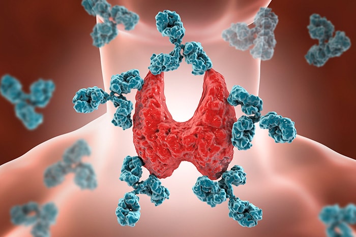 dieta-przy-hashimoto-2 Choroba Hashimoto just be fit